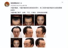 真的沒整？這些靠“換臉”翻身的男星，出道前后“判若兩人”！  第38張